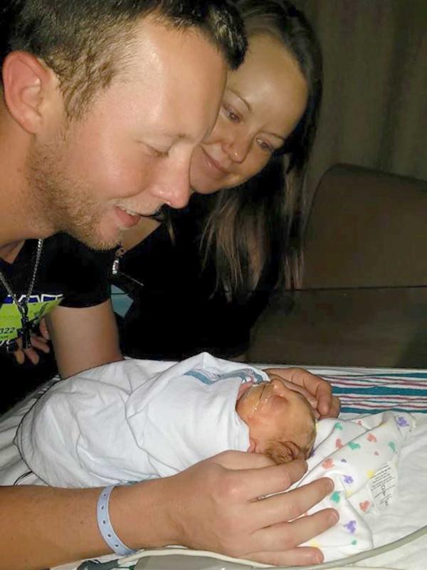 Bayi Ini Terlahir dengan Tempurung Kepala yang Tidak Sempurna | via: thesun.co.uk