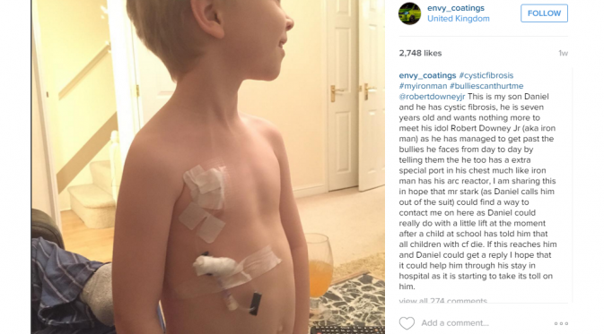 Daniel, bocah yang mengalami kelainan paru-paru dan sistem pencernaan dan penggemar berat Robert Downey Jr [foto: instagram/@envy_coatings]