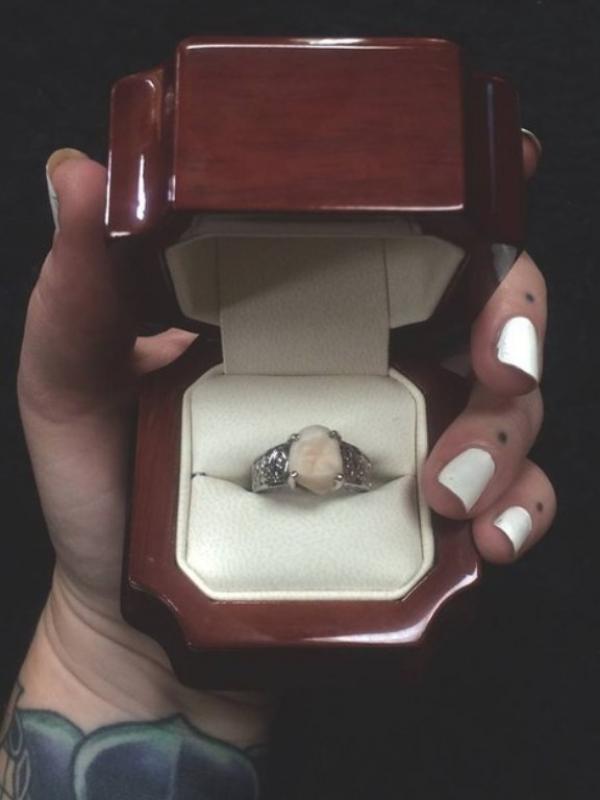 Inilah gigi yang dipilih Unger sebagai mahkota cincin pertunangannya. (Via: buzzfeed.com