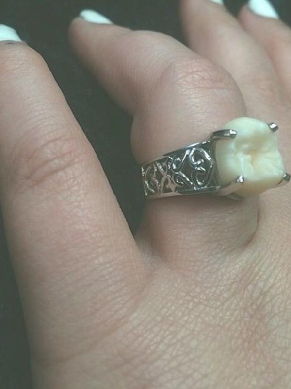 Carlee Leifkes menanggap cincin pertunangannya adalah cincin pertunangan paling keren yang pernah ia temui. (Via: buzzfeed.com