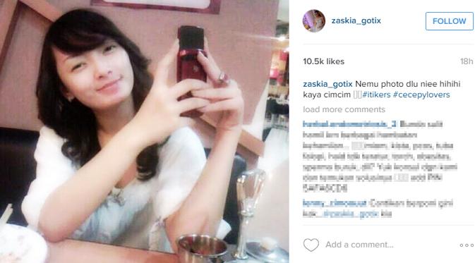 Zaskia Gotik mengunggah foto wajahnya sebelum terkenal. (foto: instagram.com/zaskia_gotix)
