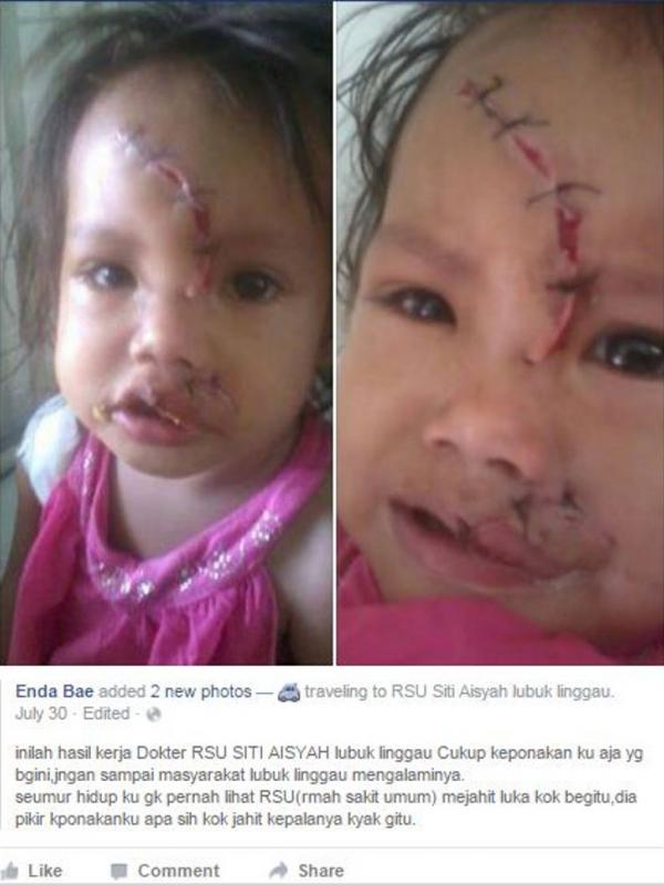 Bocah dirawat asal-asalan di sebuah rumah sakit di Sumatera Selatan  | Via: facebook.com/enda.bae