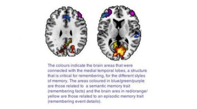 Warna biru dan ungu menunjukkan aktifitas terkait memori semantik di medial temporal lobes, sedangkan warna merah dan kuning menunjukkan aktifitas memori episodik. (foto: Science Daily)
