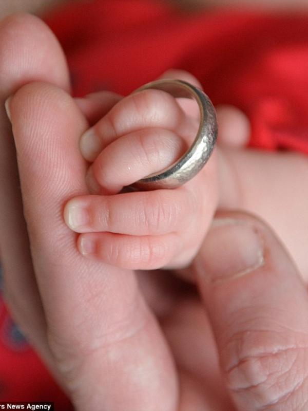 Tak Bisa Tumbuh dalam Rahim, Bayi Ini Lahir dengan Berat 0,45 Kg | via: dailymail.co.uk