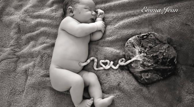 Herper, bayi yang masih lengkap dengan tali pusat dan plasentanya. (Via: facebook.com/emmajeanphotographictales)