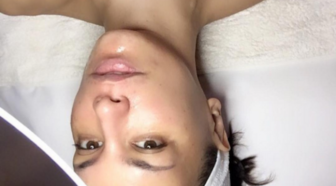 Sophia Latjuba mencoba terapi enzim DMK. Sumber: Instagram
