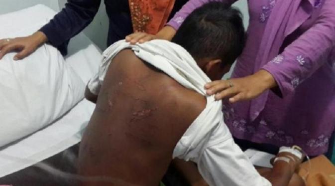 Dipukul Oknum TNI Cilandak, Bocah Malang Ini Gegar Otak Ringan | (Istimewa)