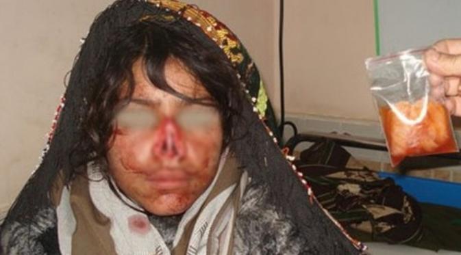 Reza Gul adalah satu dari sekian banyak perempuan yang tewas disiksa di Afghanistan. (Via: scmp.com)