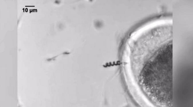 Robot mikro ini membantu sperma berenang ke arah sel telur. (Sumber IFW Dresden via American Chemical Society)