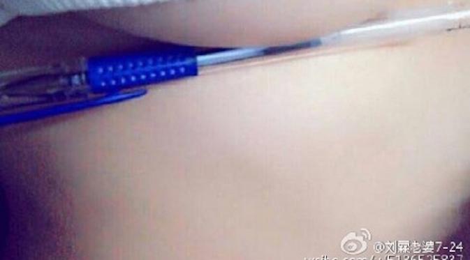 Tren menyelipkan pulpen di payudara oleh masyarakat China (sumber. Dailydot.com)