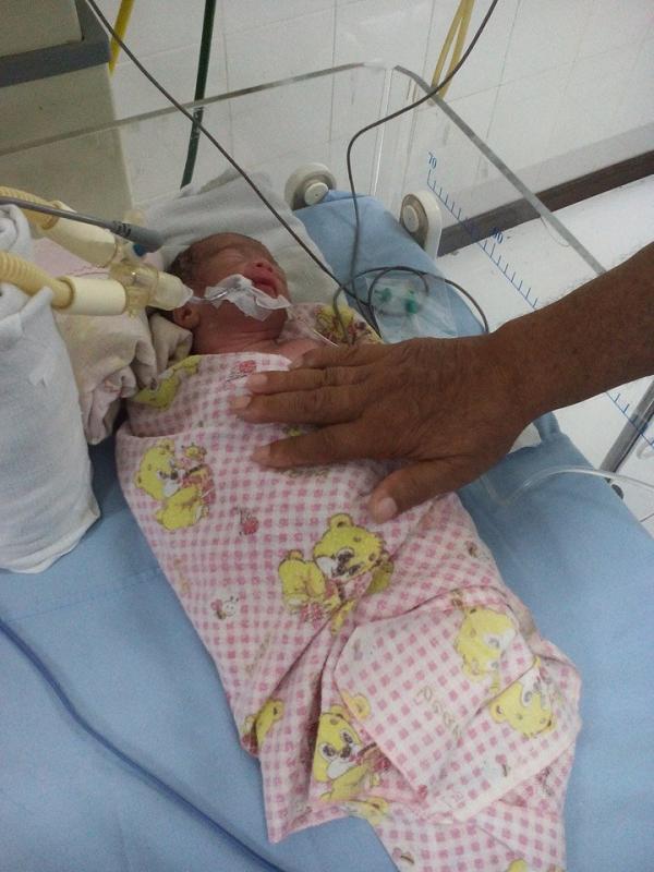 Bayi Afrizal yang kini masih dirawat di rumah sakit sebab keracunan krim pemutih yang digunakan ibunya saat hamil | Via: facebook.com/Afrizal