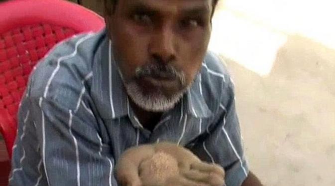 Hans Raj, laki-laki asal India yang kecanduan makan pasir. (Caters News Agency)