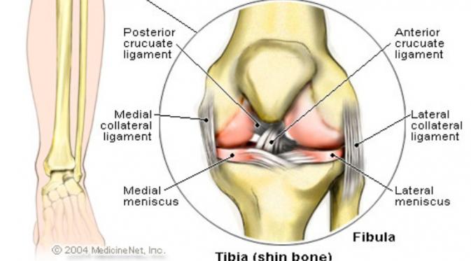 Gambaran cedera lutut anterior cruciate ligament. (dok. Medicinet.com)