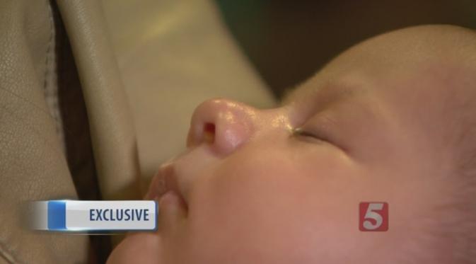 Nate, bayi korban salah operasi lidah. (Via: newschannel5.com)