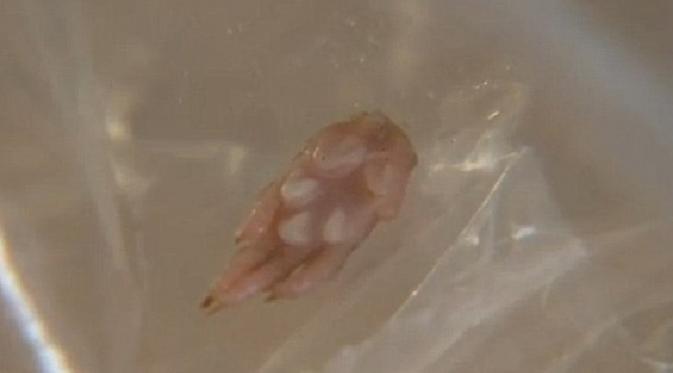 Benda yang diduga kaki tikus ini ditemukan di dalam sosis yang tengah dimakan anaknya (Foto: news.com.au).