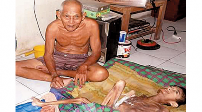 Sifa, pengidap gizi buruk dari Pangandaran, Jawa Barat, dan Kakek Totong