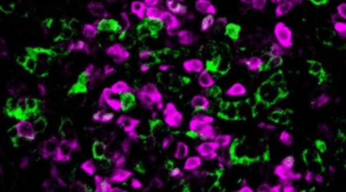 Jumlah sel  Sertoli (warna hijau) yang terdapat dalam testis langsung melonjak dalam tikus ketika gen Dmrt1 diaktifkan kembali. (Sumber Popular Science)