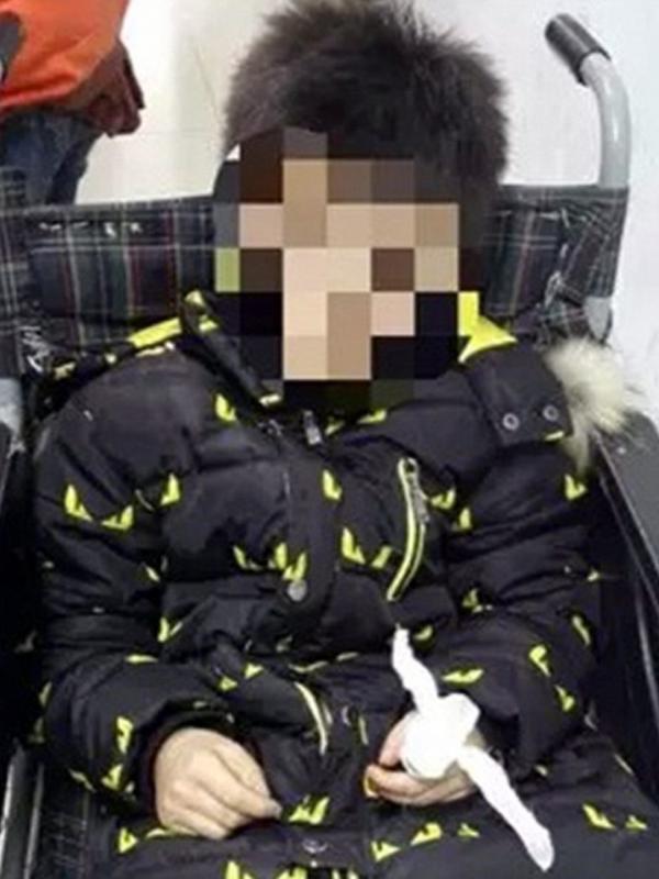 Bocah lelaki asal Tiongkok yang memotong jarinya karna dilarang main 'smartphone'. (CEN)