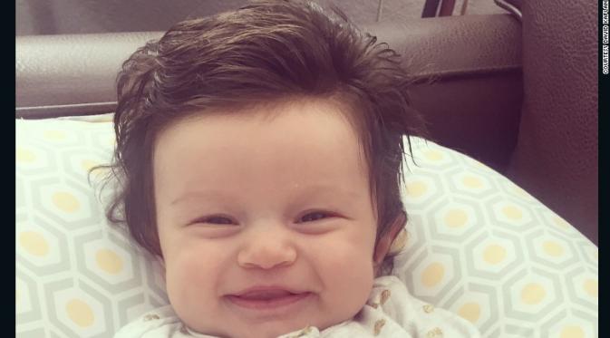 Bayi bernama Isabelle yang memiliki rambut tebal seperti orang dewasa. (CNN)