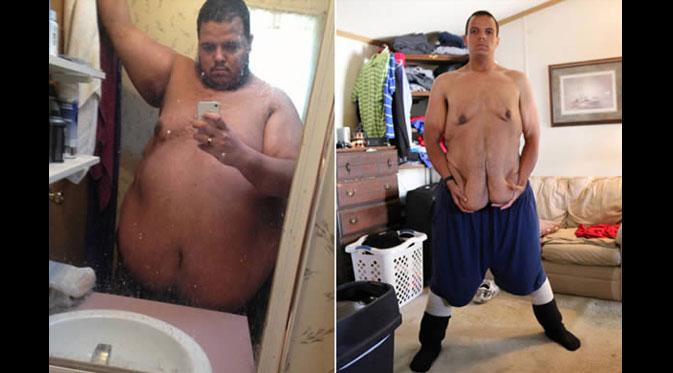 7 Orang yang menginspirasi dunia dengan kesuksesan menurunkan berat badan | Via: oddee.com