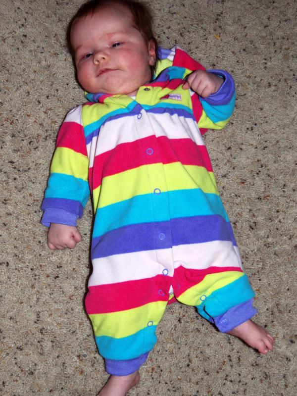 Elsie Moravek, anak yang terlahir dengan panjang kaki tak sama. (PA Real Life)