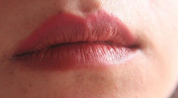 Bibir tipis di bawah. (Via: infoskep.com)