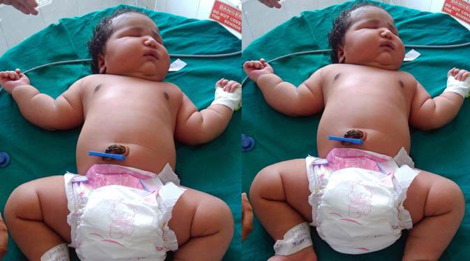 Seorang perempuan dari India telah  melahirkan bayi cantik seberat 6, 7 kilo gram.