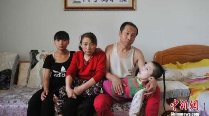 Pasangan Zhao Yuchun dan Li Huanmei dari Shanxi, China ini sungguh mengharukan banyak orang. 