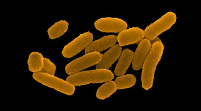 Bakteri Y. Pestis penyebab pandemi Black Death dan Great Plague (Dennis Kunkel Microscospy, Inc., Visual Unlimited, Corbis)