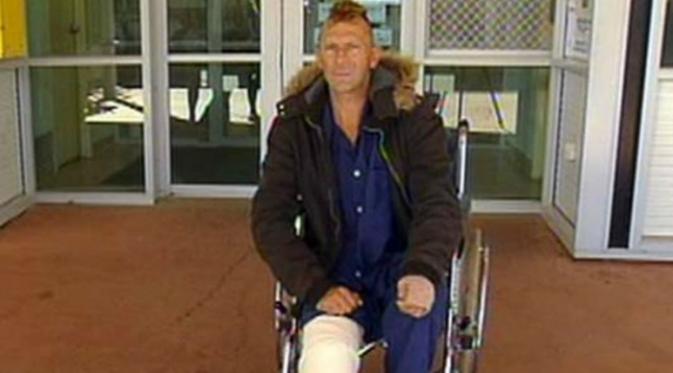 Kaki Michael Newman terluka karena serangan buaya setelah ia berusaha menungganginya (ABC News)