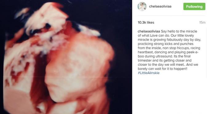 Usia kandungan Chelsea Olivia menginjak trimester akhir. (Instagram)
