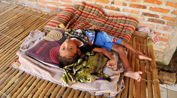 Seorang bocah berumur 8 tahun bernama Indrawan terbaring di tempat tidur di Dusun III nomor 21, Kampung Katimaha, Bekasi, Jawa Barat, (11/7). Anak ini mengalami kelainan tulang belakang sejak usia tiga bulan. (Liputan6.com/Gempur M Surya)