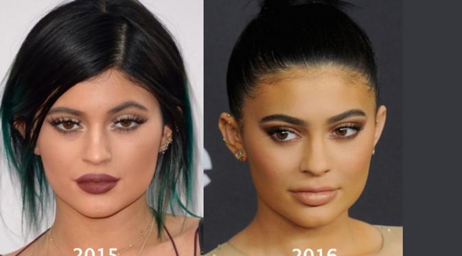 Menyadari bibirnya terlalu tebal, Kylie Jenner kembali merombak bentuk bibirnya (RadarOnline)