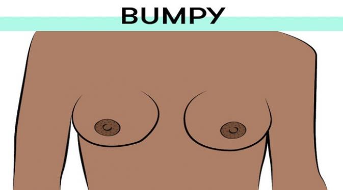 The Bumpy Nipples. Sumber : yourtango.com