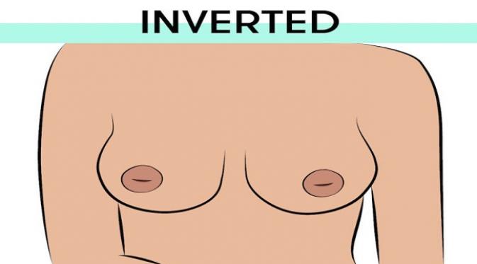 The Inverted Nipples. Sumber : yourtango.com