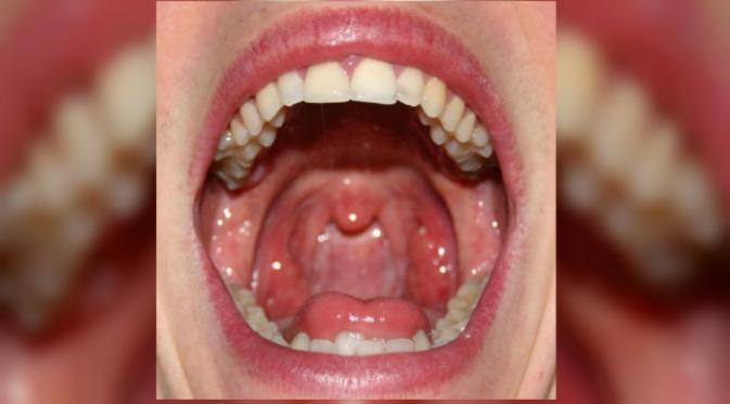 Jadi, sebenarnya misteri apakah yang menyelimuti gigi, gusi, ludah, dan lidah manusia yang membuat penasaran? (Sumber anatomy-diagram.info)