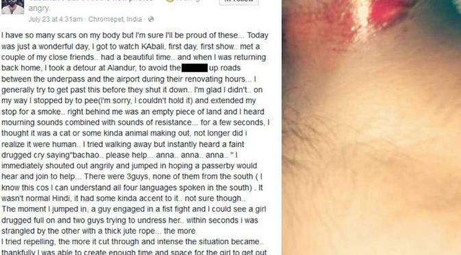  Vasanth Paul mengalami luka setelah menyelamatkan seorang gadis dari pemerkosaan (Facebook)