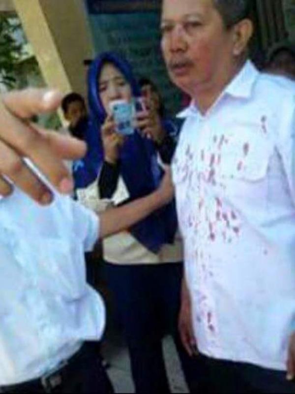 Begini Kondisi Guru SMKN 2 Makassar yang Dipukul Orangtua Siswa. (Foto: Facebook/Meme & Rage Comic Indonesia)