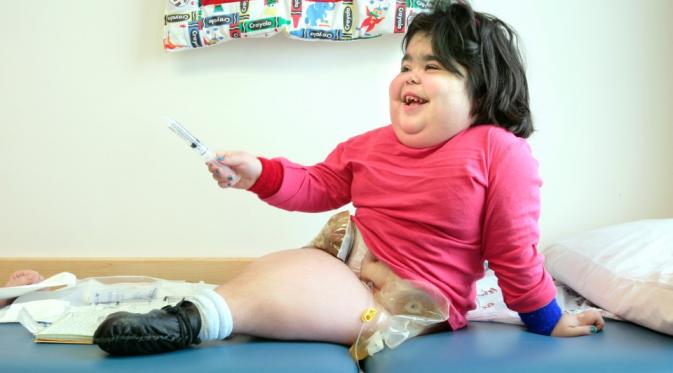 Shiloh Pepin, penderita Sindrom Mermaid yang akhirnya meninggal di usia 10 tahun. | via: thesun.co.uk
