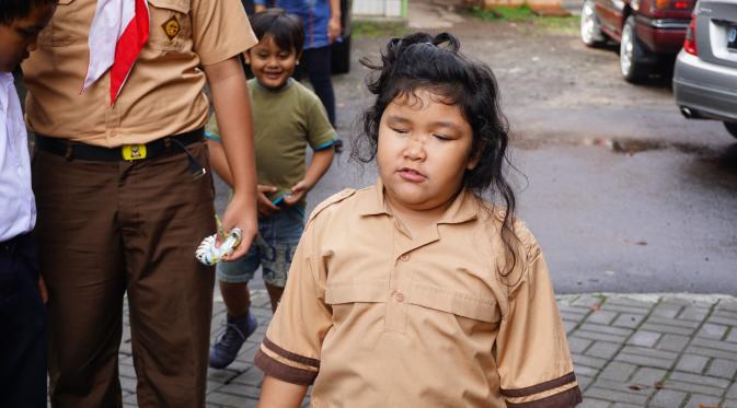 Anak-anak berkebutuhan khusus di SLB A Bandung.
