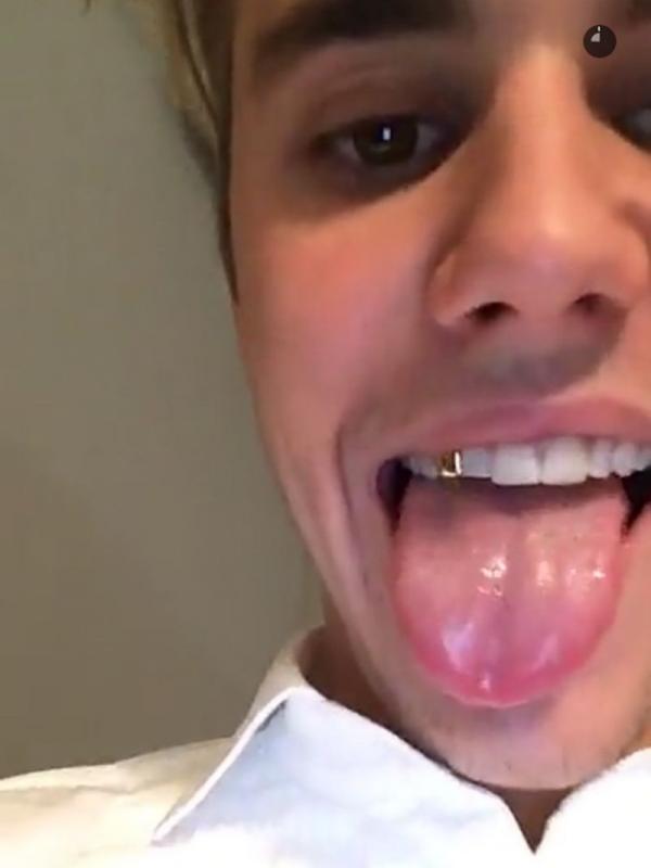 Justin Bieber memasang Grill di giginya. (MTV)