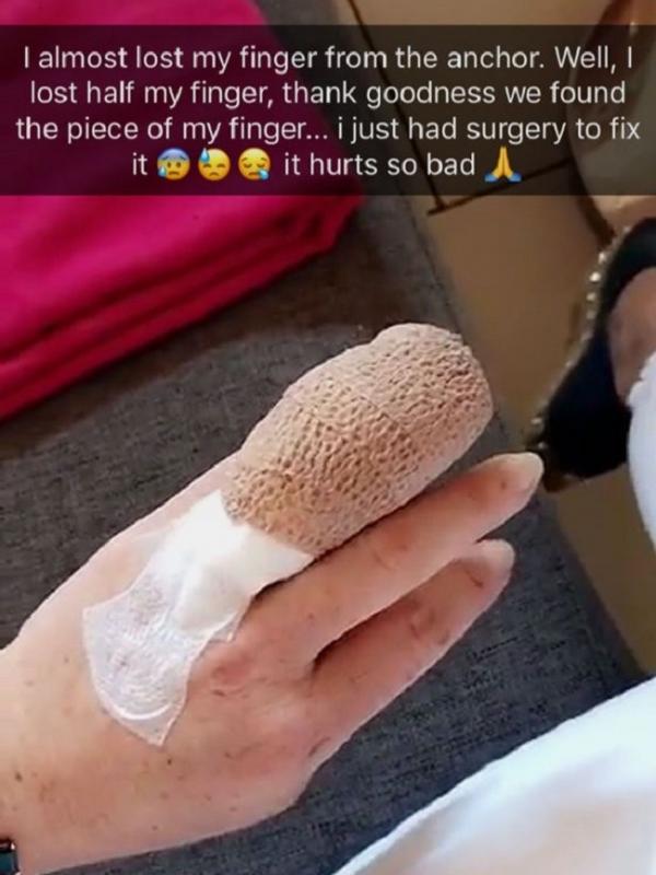 Lindsay Lohan hampir kehilangan jarinya karena kecelakaan. (Mirror)