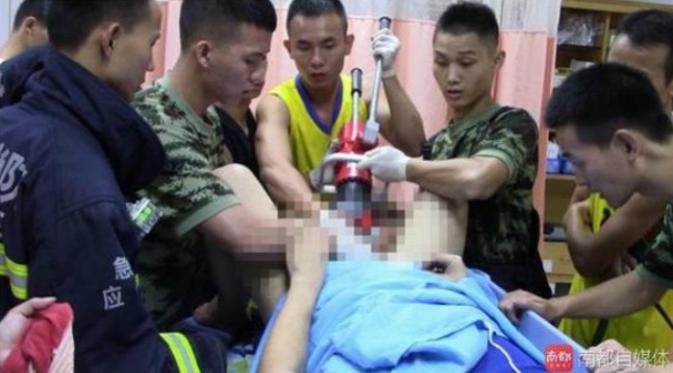 10 orang petugas pemadam kebakaran Kota Zhongshan dan tentara dikerahkan untuk membantu melepaskan jeratan magnet pada buah zakarnya.
