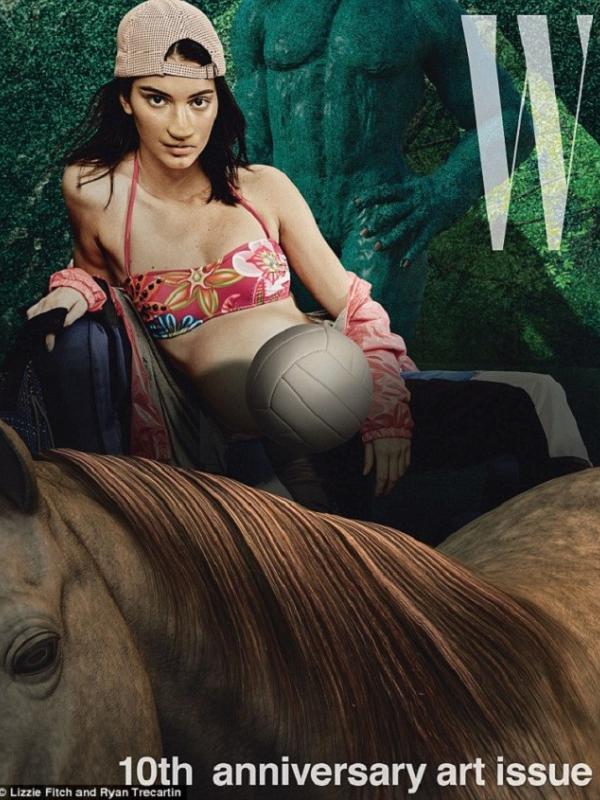 Gigi Hadid dan Kendall Jenner tak memiliki lutut saat menjadi model sampul majalah W. (Dailymail)