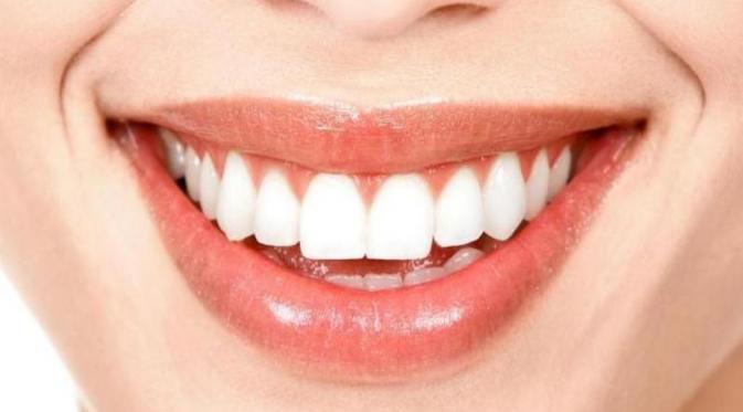 Ilustrasi gigi putih. (via: kusuka.com)