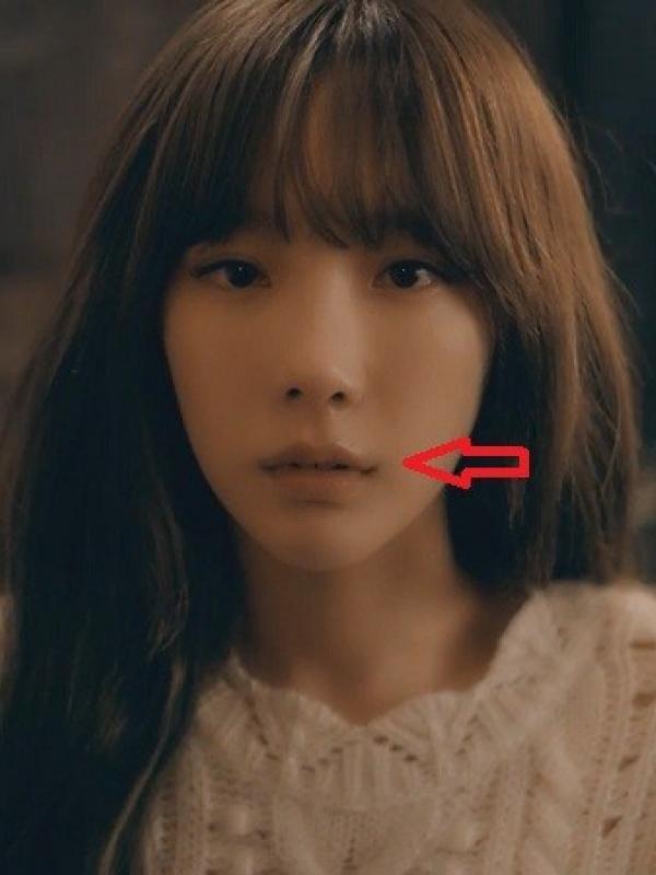 Taeyeon SNSD oplas di bagian wajah?