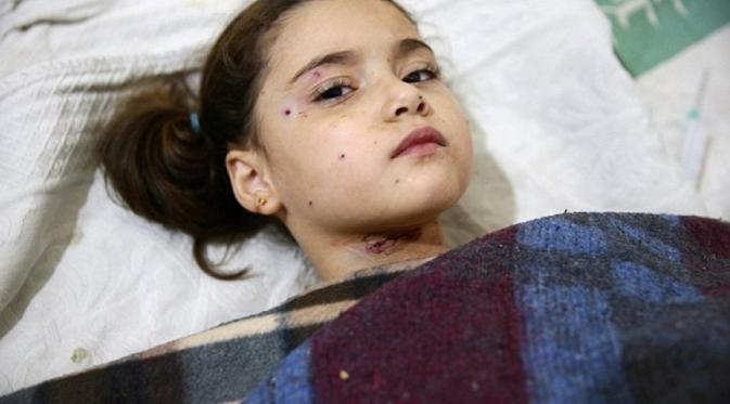 Bocah Suriah korban bom rezim Presiden Bashar al-Assad. (Reuters)