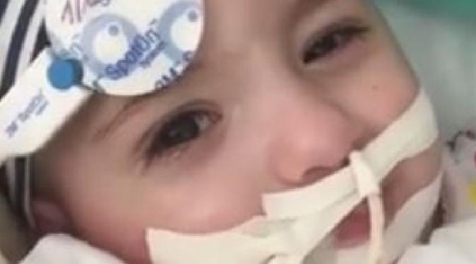 Marwa kembali membuka matanya ketika dokter berencana untuk melepas alat bantu bernafasnya (News.com.au)