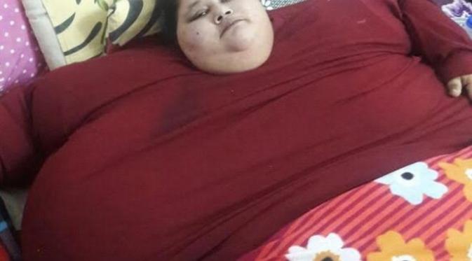 Abd El Aty asal Mesir dijuluki wanita terberat di dunia dengan berat badan mencapai 500 kg. (Sumber: Dr. Muffazal Lakdawala, BBC)