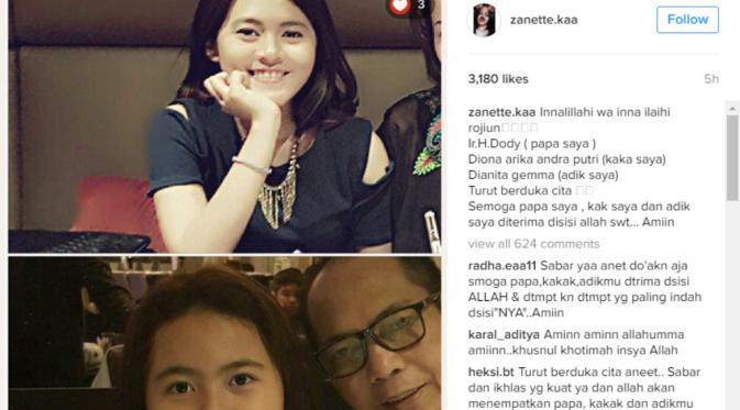 Ini foto kedua yang diunggah oleh Zanette, korban selamat pembunuh sadis di Pulomas. (Foto: Instagram)